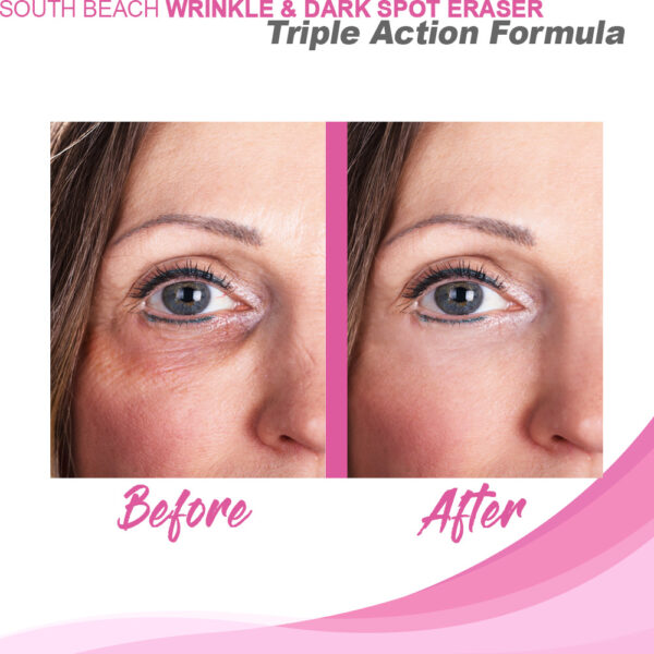 South Beach Wrinkle & Dark Spot Eraser